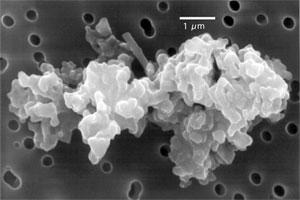 A scanning electron microscope image of an interplanetary dust particle. (Courtesy E.K. Jessberger, Institut für Planetologie, and Don Brownlee, University of Washington)